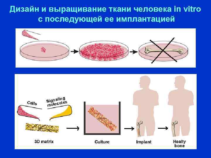 Дизайн и выращивание ткани человека in vitro с последующей ее имплантацией 