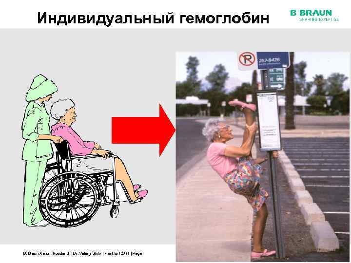 Индивидуальный гемоглобин B. Braun Avitum Russland | Dr. Valeriy Shilo | Frankfurt 2011 |