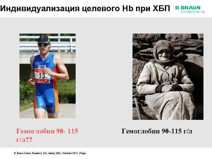 Индивидуализация целевого Hb при ХБП Гемоглобин 90 - 115 г/л? ? B. Braun Avitum