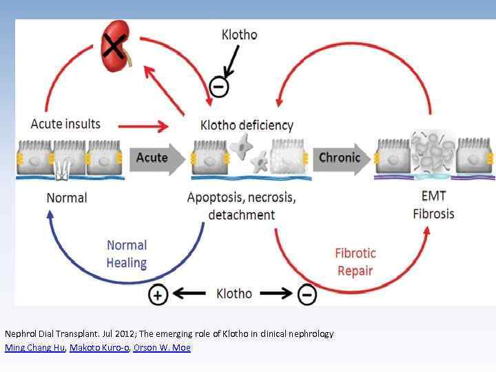 Nephrol Dial Transplant. Jul 2012; The emerging role of Klotho in clinical nephrology Ming