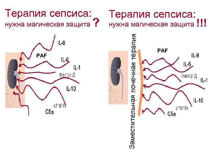 нужна магическая защита PAF ? Терапия сепсиса: нужна магическая защита !!! Заместительная почечная терапия