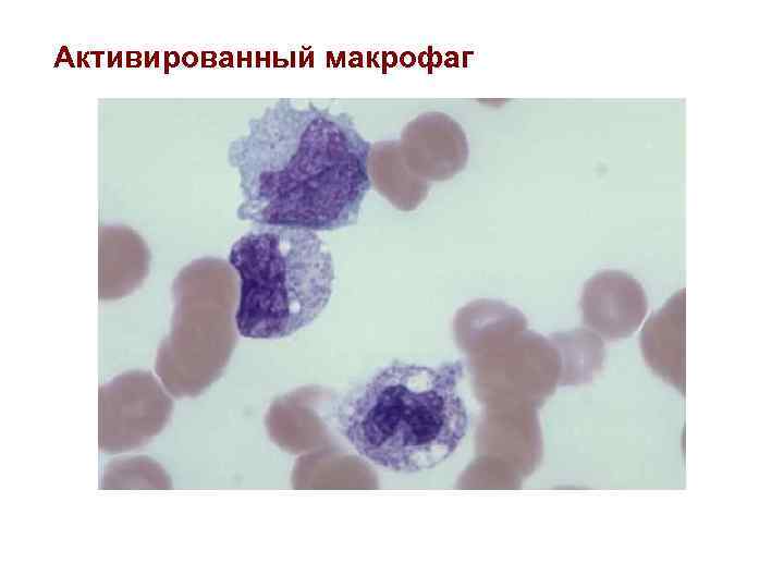 Активированный макрофаг 