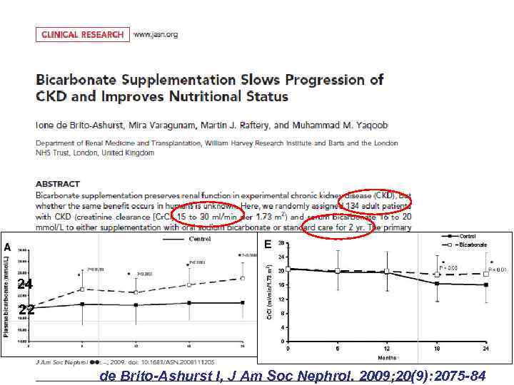 24 22 de Brito-Ashurst I, J Am Soc Nephrol. 2009; 20(9): 2075 -84 