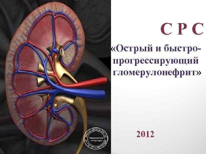 СРС «Острый и быстропрогрессирующий гломерулонефрит» 2012 