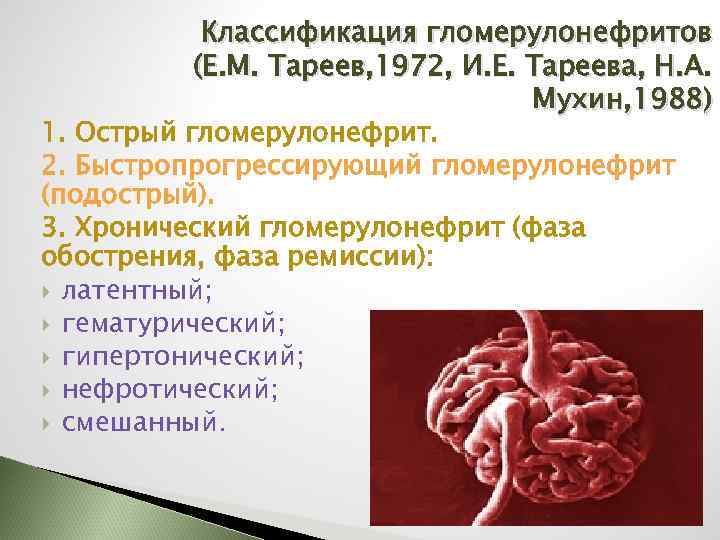 Классификация гломерулонефритов (Е. М. Тареев, 1972, И. Е. Тареева, Н. А. Мухин, 1988) 1.