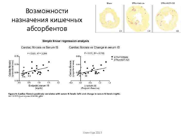 Возможности назначения кишечных абсорбентов Улан-Удэ 2013 
