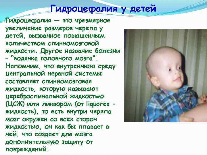 Гидроцефалия у детей Гидроцефалия — это чрезмерное увеличение размеров черепа у детей, вызванное повышенным