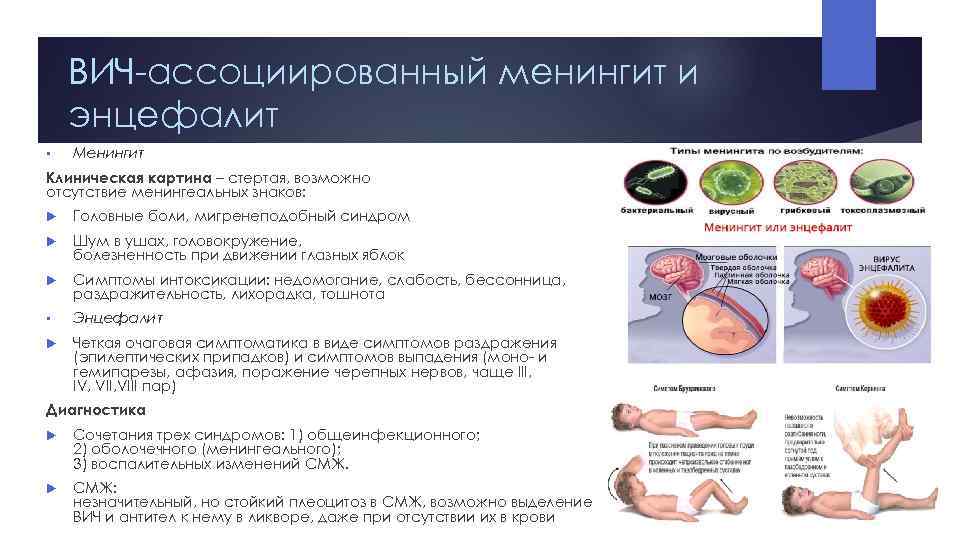 ВИЧ ассоциированный менингит и энцефалит • Менингит Клиническая картина – стертая, возможно отсутствие менингеальных