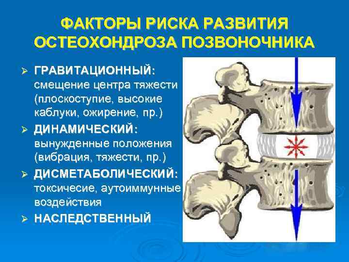 ФАКТОРЫ РИСКА РАЗВИТИЯ ОСТЕОХОНДРОЗА ПОЗВОНОЧНИКА ГРАВИТАЦИОННЫЙ: смещение центра тяжести (плоскоступие, высокие каблуки, ожирение, пр.