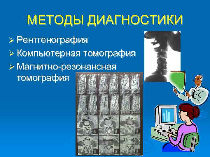 МЕТОДЫ ДИАГНОСТИКИ Ø Рентгенография Ø Компьютерная томография Ø Магнитно-резонансная томография 