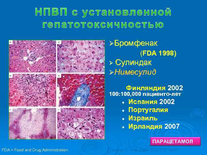 ØБромфенак (FDA 1998) Ø Сулиндак ØНимесулид Финляндия 2002 100: 100, 000 пациенто-лет l l