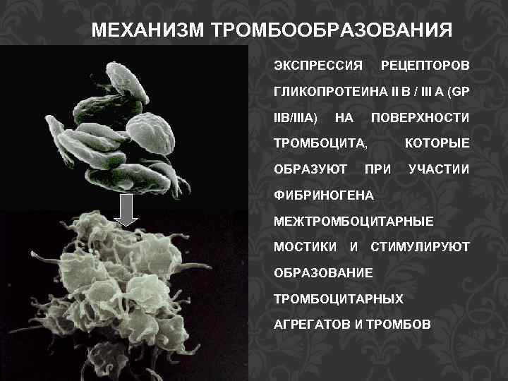 МЕХАНИЗМ ТРОМБООБРАЗОВАНИЯ ЭКСПРЕССИЯ РЕЦЕПТОРОВ ГЛИКОПРОТЕИНА II B / III A (GP IIB/IIIA) НА ПОВЕРХНОСТИ