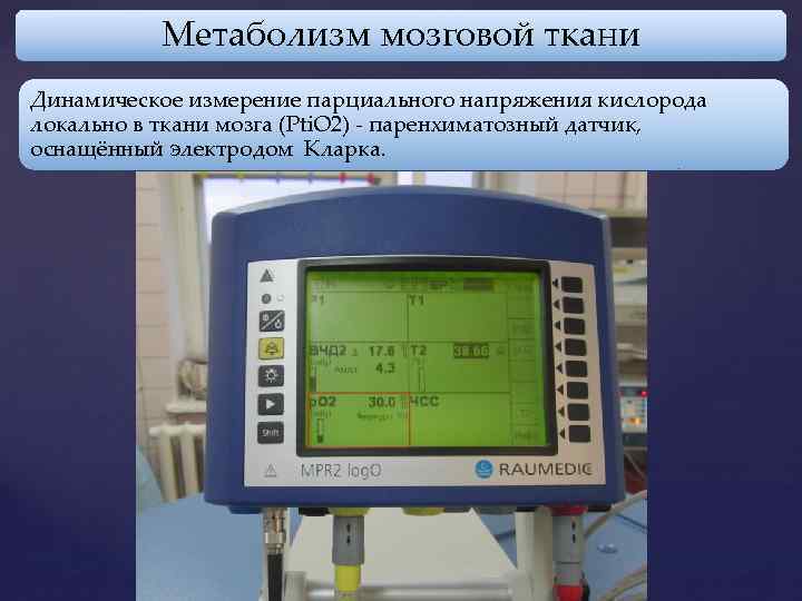 Метаболизм мозговой ткани Динамическое измерение парциального напряжения кислорода локально в ткани мозга (Pti. O