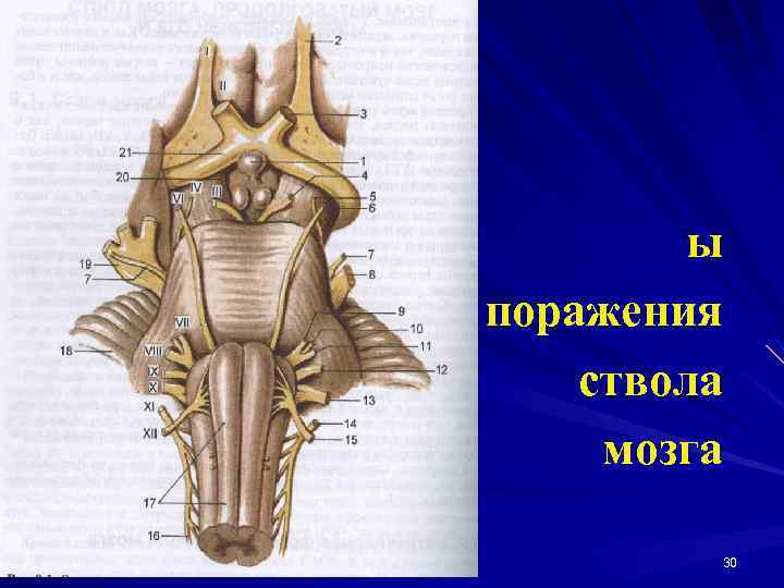 ы поражения ствола мозга 30 