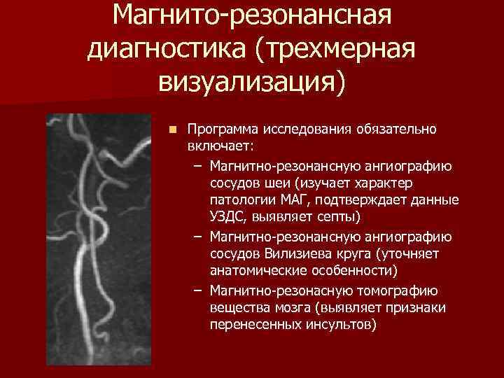 Магнито-резонансная диагностика (трехмерная визуализация) n Программа исследования обязательно включает: – Магнитно-резонансную ангиографию сосудов шеи