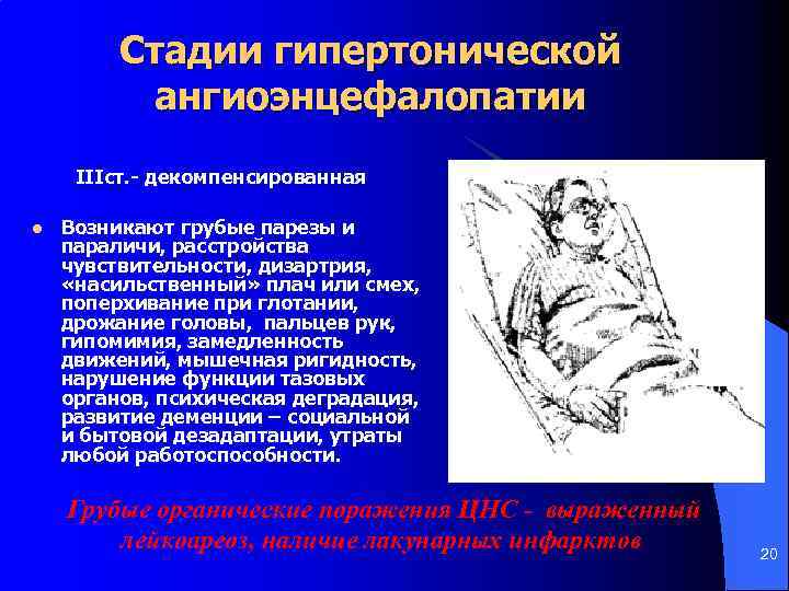 Стадии гипертонической ангиоэнцефалопатии IIIст. - декомпенсированная l Возникают грубые парезы и параличи, расстройства чувствительности,