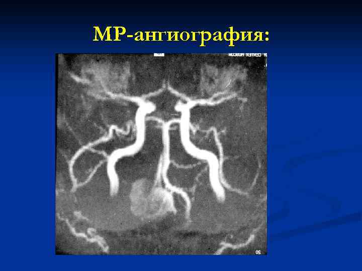 МР-ангиография: 