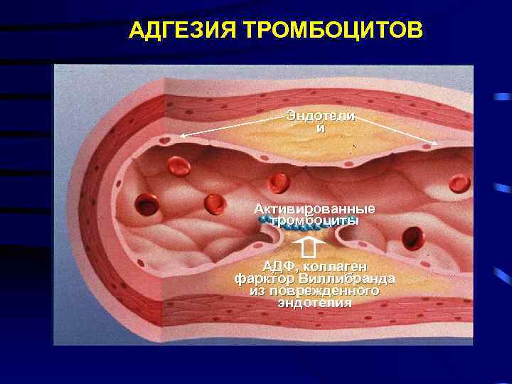 АДГЕЗИЯ ТРОМБОЦИТОВ Эндотели й Активированные тромбоциты АДФ, коллаген фарктор Виллибранда из поврежденного эндотелия 