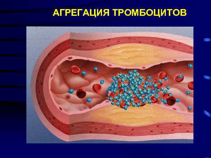 АГРЕГАЦИЯ ТРОМБОЦИТОВ 