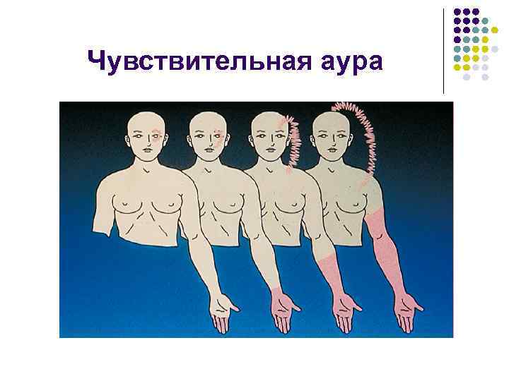 Чувствительная аура 