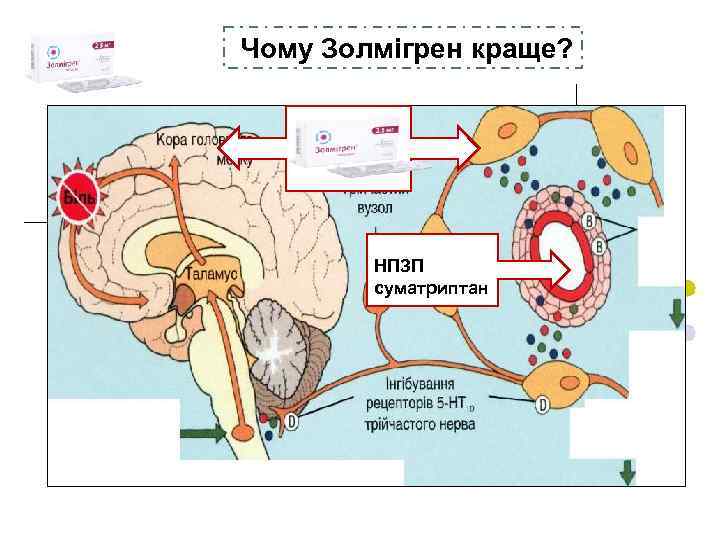 Чому Золмігрен краще? Золмігрен НПЗП суматриптан 