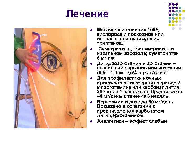 Лечение l l l Масочная ингаляция 100% кислорода и подкожное или интраназальное введение триптанов.
