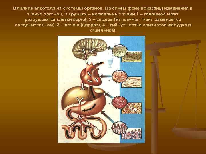 Влияние алкоголя на системы органов. На синем фоне показаны изменения в тканях органов, в