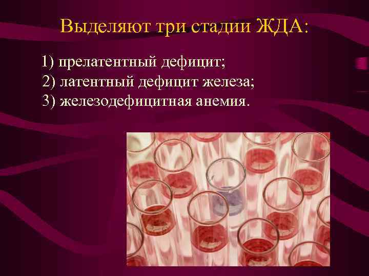 Выделяют три стадии ЖДА: 1) прелатентный дефицит; 2) латентный дефицит железа; 3) железодефицитная анемия.