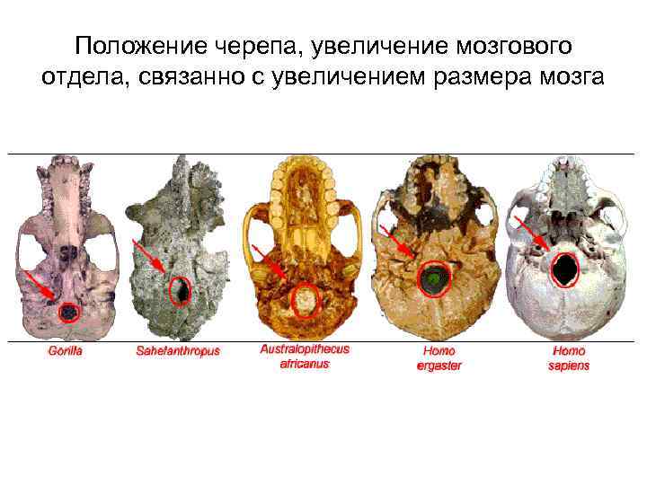 Положение черепа, увеличение мозгового отдела, связанно с увеличением размера мозга 