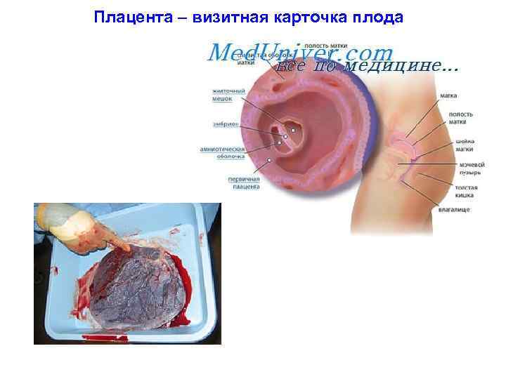 Плацента – визитная карточка плода 