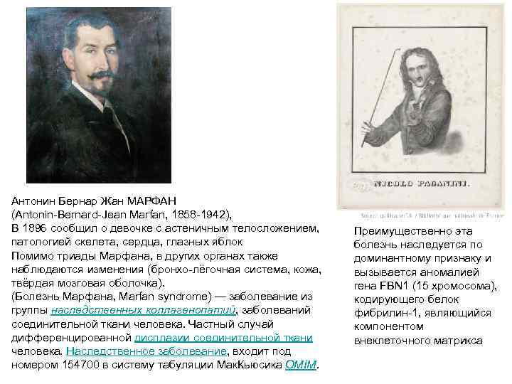 Антонин Бернар Жан МАРФАН (Antonin-Bernard-Jean Marfan, 1858 -1942), В 1896 сообщил о девочке с