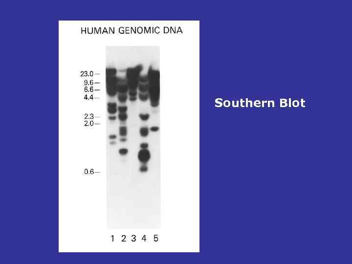 Southern Blot 