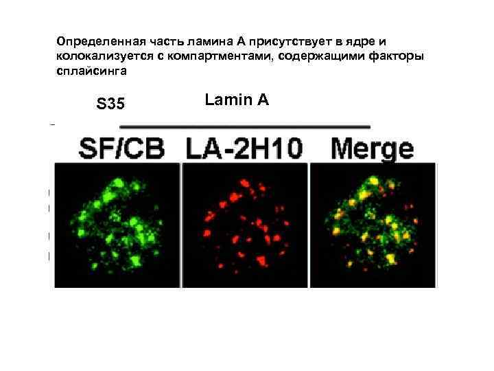 Определенная часть ламина А присутствует в ядре и колокализуется с компартментами, содержащими факторы сплайсинга