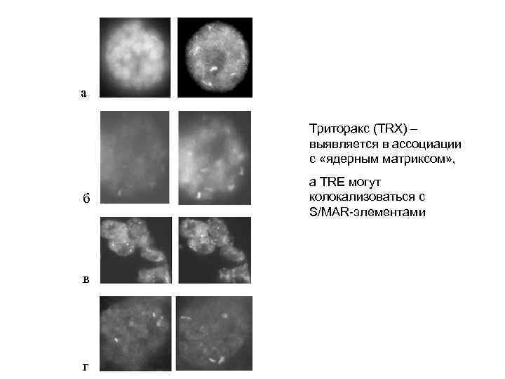 а Триторакс (TRX) – выявляется в ассоциации с «ядерным матриксом» , б в г