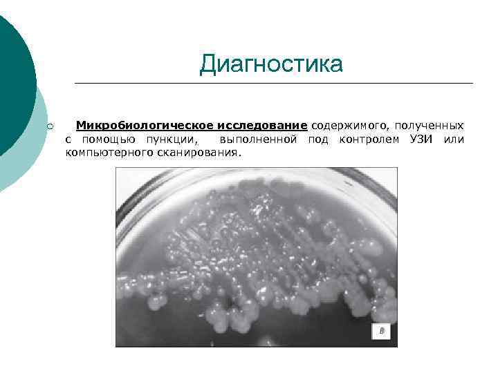 Диагностика ¡ Микробиологическое исследование содержимого, полученных с помощью пункции, выполненной под контролем УЗИ или