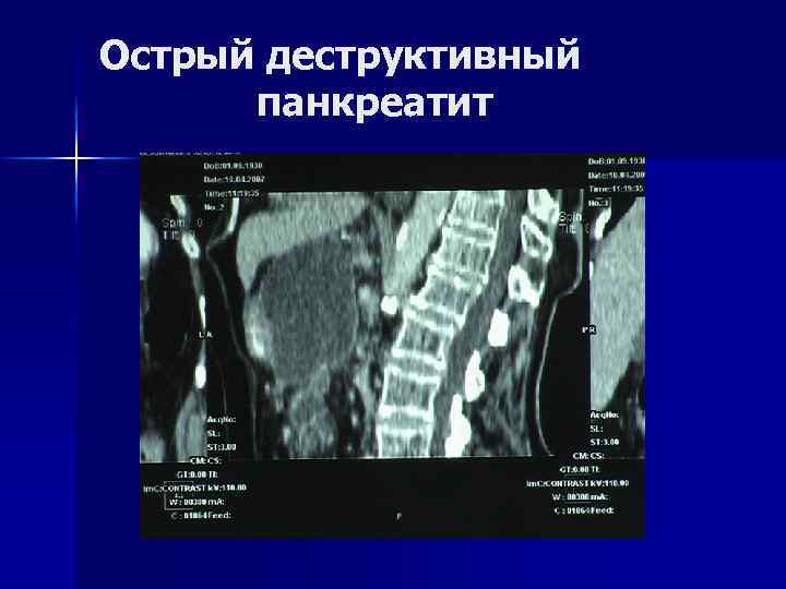 Острый панкреатит карта вызова скорой медицинской помощи шпаргалка