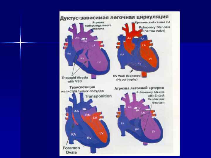 Транспозиция магистральных артерий презентация