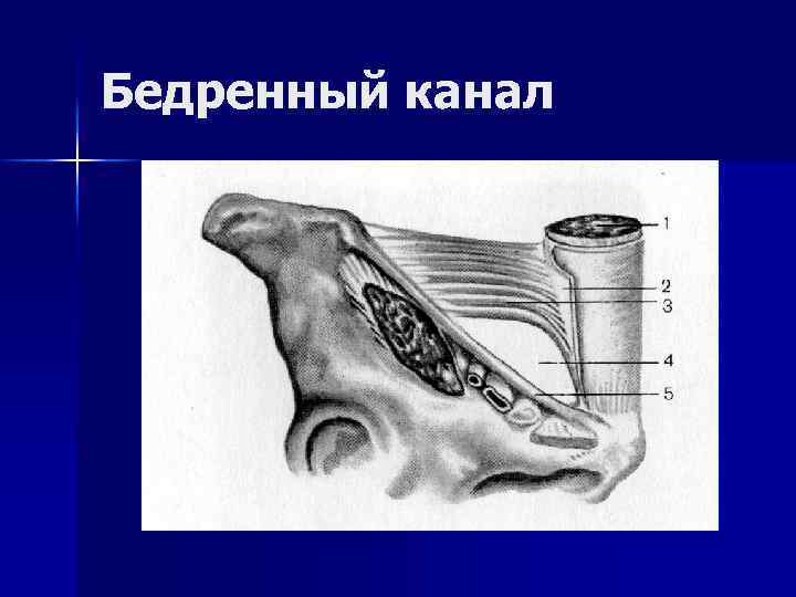 Бедренный канал рисунок