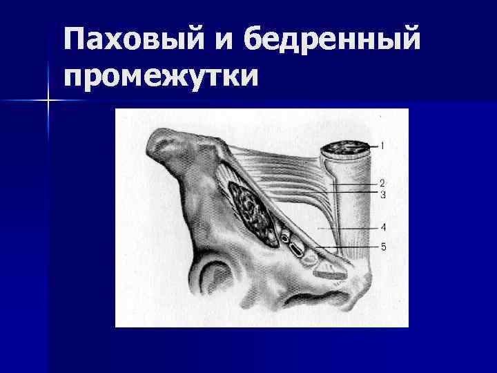 Паховый канал у детей