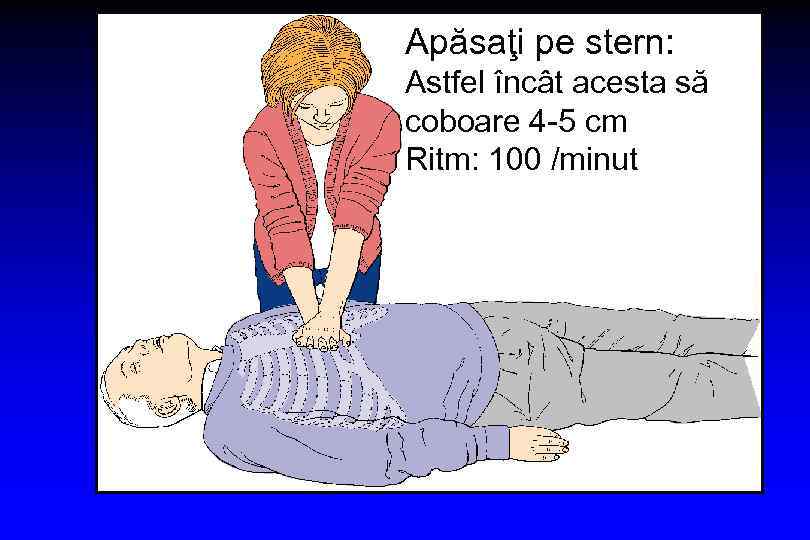 Apăsaţi pe stern: Astfel încât acesta să coboare 4 -5 cm Ritm: 100 /minut