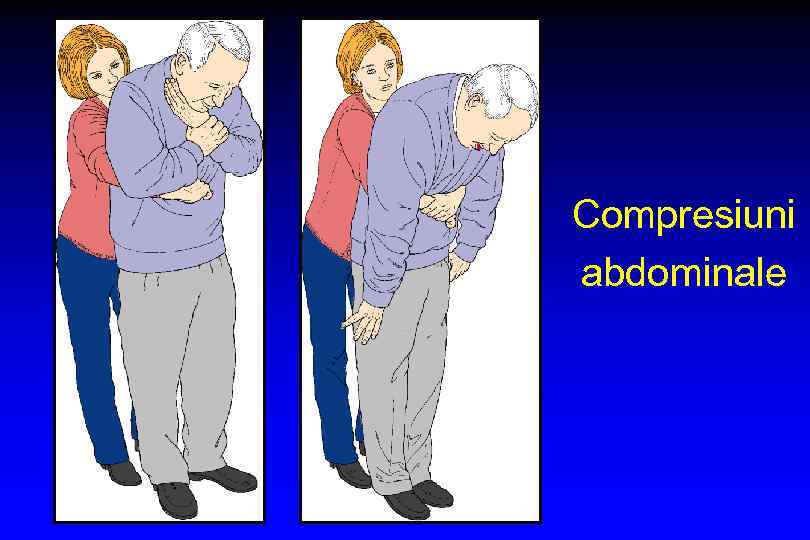 Compresiuni abdominale 