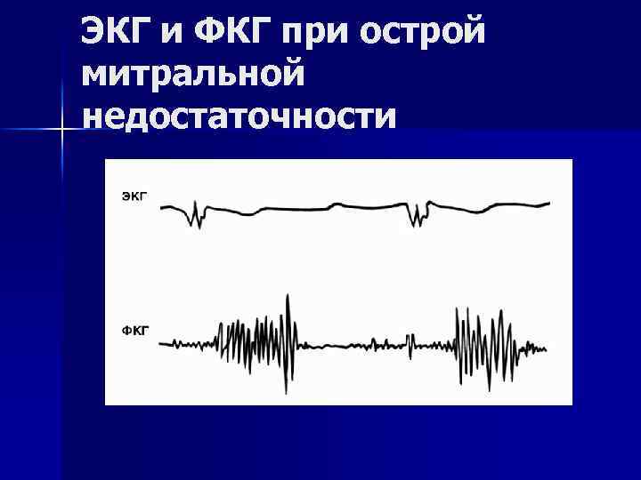 Аускультативная картина