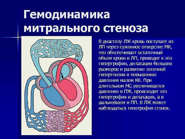 Схема гемодинамики при пороках сердца