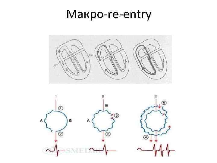 Макро-re-entry 