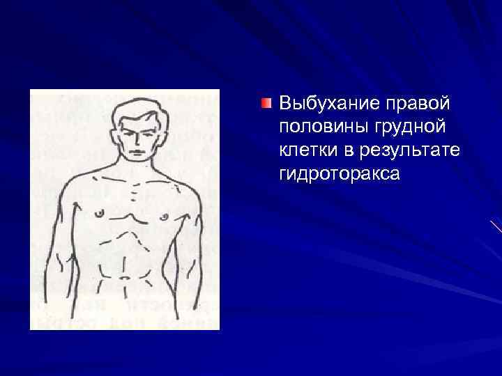 Правую половину грудной клетки