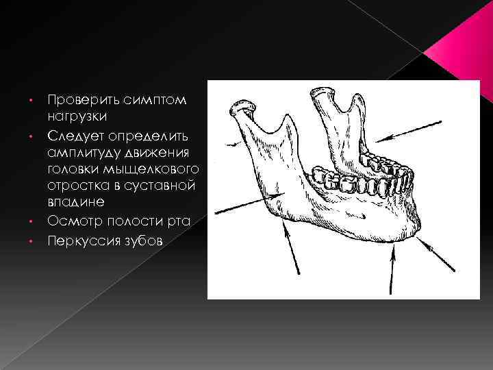 Перелом мыщелкового отростка нижней челюсти. Перелом нижней челюсти симптом нагрузки. Перелом нижней челюсти симптом осевой нагрузки. Симптом нагрузки на нижнюю челюсть. Симптом нагрузки при переломах нижней челюсти.