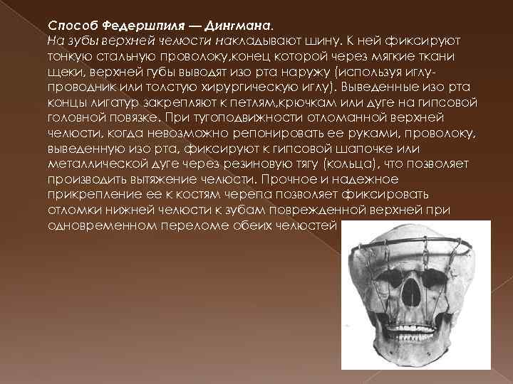 Способ Федершпиля — Дингмана. На зубы верхней челюсти накладывают шину. К ней фиксируют тонкую