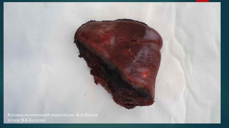 Клиника госпитальной хирургии им. В. А. Оппеля хирург В. К. Балашов 