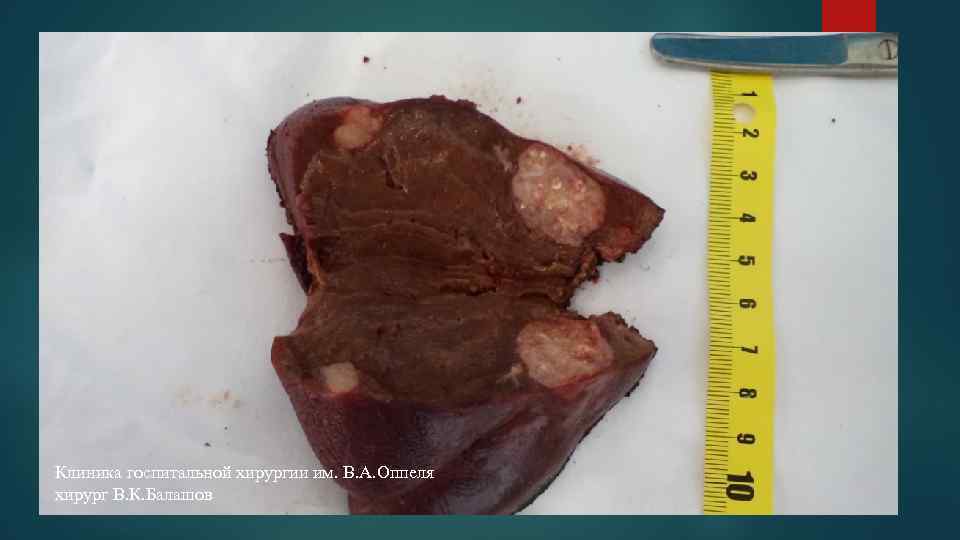 Клиника госпитальной хирургии им. В. А. Оппеля хирург В. К. Балашов 