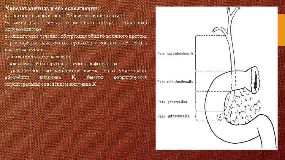 Холедохолитиаз и его осложнения: а. частота - выявляется в 12% всех холецистэктомий б. камни